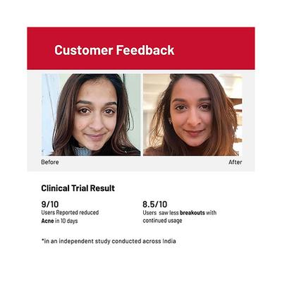 Chemist At Play Acne Control Face Serum 30 ml - Face Serum