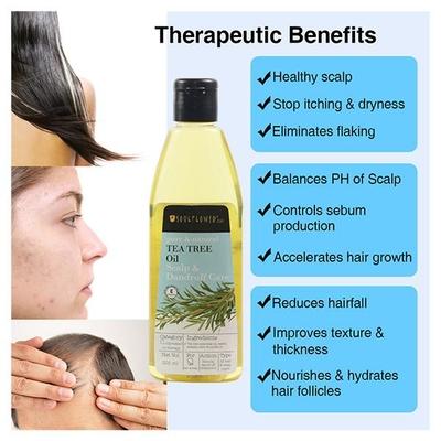 Soulflower Anti Dandruff Tea Tree Hair Oil 225 ml - Hair Oils