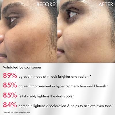 Mcaffeine Clear Glow 2% Alpha Arbutin Kojic Acid Brightening Serum Pads with 3% Niacinamide 40's - Face Serum