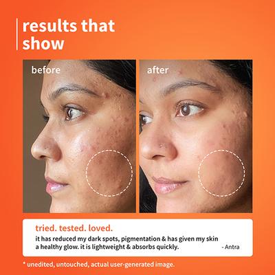 Plum Calendula & 10% Vitamin C Barrier Boosting + Glow Serum Boosts Glow Builds Skin Barrier 30 ml - Essences