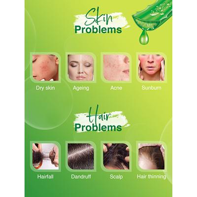 Spantra Aloevera Gel 300 ml - Face Gels