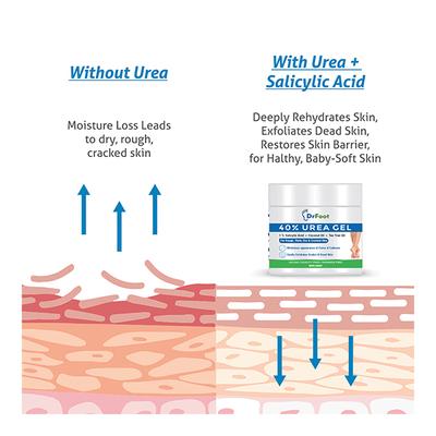 Dr Foot 40% Urea Gel 100 gm - Foot Creams & Lotions