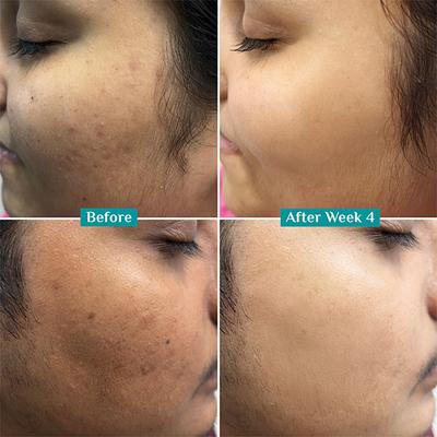 Pilgrim 10% Vitamin C Face Serum For Daily Brightness 30 ml - Face Mists