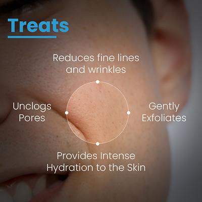 Fixderma Cosmetic Laboratories (FCL) Penta Peel Pads 1's - Masks & Peels