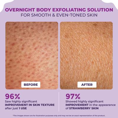 Sanfe Clear and Confident Overnight Glow Body Cream Exfoliates Reduces Dark Patches Pigmentation 100 gm - Creams, Lotions & Oils