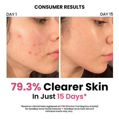 ThriveCo Acne-Free Sun Defense Kit (Anti-Acne Serum + Face Wash + SPF 50 PA++++ Sunscreen) 1's - Facial Kits