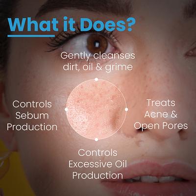 Fixderma Cosmetic Laboratories (FCL) Alpha Beta Acne Face Cleanser 200 ml - Face Wash & Cleansers