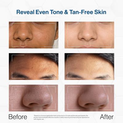Fixderma Cosmetic Laboratories (FCL) De Tan Face mask 100 gm - Masks & Peels
