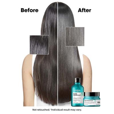 L'Oreal Professionnel Scalp Advanced Anti-Oiliness Dermo-Purifier Shampoo 300 ml - Shampoos