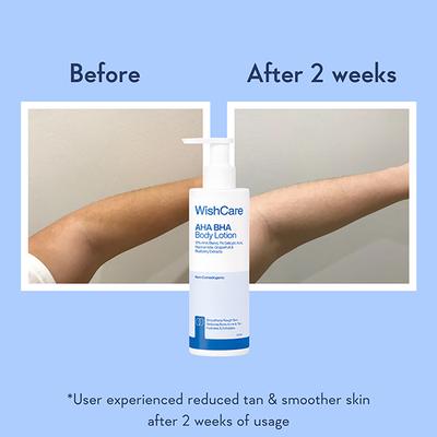 Wishcare AHA + BHA Exfoliating Body Lotion-Provides Deep Hydration & Detan Skin (200ml) - Lotions & Creams