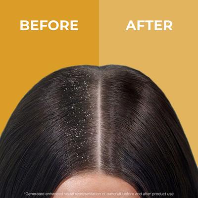 Organic Forest Anti Dandruff Shampoo 100 ml - Shampoos