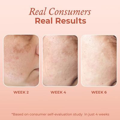 The Pink Foundry Dark Spot And Hyperpigmentation Correcting Power Serum 30 ml - Face Serum