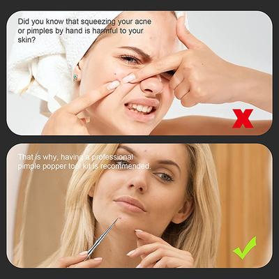 Majestique Blackhead Remover FC56 1's - Others