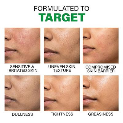 Novology Acne Light Moisturizing Gel for Oily, Acne Prone Skin - Upto 100 Hours of Hydration 50 gm - Face Moisturizers