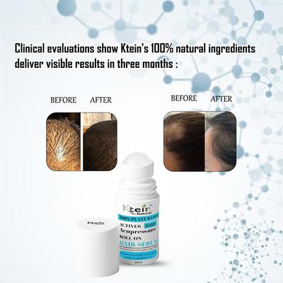 Ktein 100% Plant-Based Active Intensive Hair Treatment Serum with Acupressure Roll-On Therapy 30 ml - Hair Serums