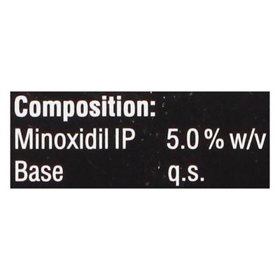 MINCIDENZ 5 Topical Solution 60ml - Hair Loss-Oth