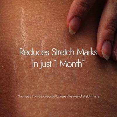 Kapiva Skin Rituals Ghee Kumkumadi Stretch Mark Cream 200 gm - Skin-Treatment