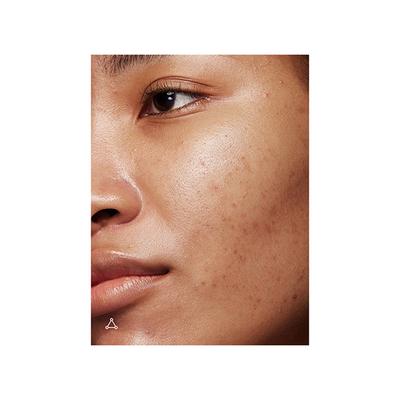 Allies Of Skin Promise Keeper Nightly Blemish Treatment 50 ml - Masks & Peels