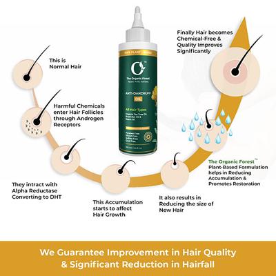 Organic Forest (100% Chemical-Free) Anti Dandruff Hair Oil 100 ml - Hair Oils