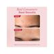 The Pink Foundry Overnight Acne Spot Corrector 15 ml - Skin-Treatment