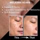 House of Beauty Multivitamin Instant Filler Peptide Serum 30 ml - Face Serum