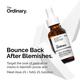The Ordinary Aloe 2% + NAG 2% Solution (INT) 30 ml - Face Serum