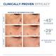 Bioderma Pigmentbio C- Concentrate Brightening Cream Corrector Pigmentation Disorders 15 ml - Face Serum