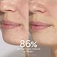Caudalie Vinopure Blemish Control Salicylic Serum 30 ml - Face Serum