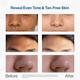 Fixderma Cosmetic Laboratories (FCL) De Tan Face mask 100 gm - Masks & Peels