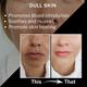 House of Beauty Jade Roller For Oily Skin Helps Tone, Tighten, Depuff Face & Under Eyes 1's - Derma Rollers