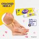 Krack Heel Repair Cream 15 gm - Manicure & Pedicure Kits