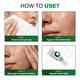 Novology Acne Light Moisturizing Gel for Oily, Acne Prone Skin - Upto 100 Hours of Hydration 50 gm - Face Moisturizers