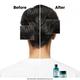 L'Oreal Professionnel Scalp Advanced Anti-Oiliness Dermo-Purifier Shampoo 300 ml - Shampoos