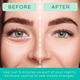Patchology Flashpatch Restoring Night Eye Gels 5's - Eye Gels & Roll-On