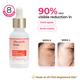 The Pink Foundry Dark Spot And Hyperpigmentation Correcting Power Serum 30 ml - Face Serum