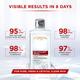 L'Oreal Paris Revitalift Crystal Purifying Micellar Water With Oil-Free Technology, Cleanses pores & removes makeup 400 ml - Face Wash & Cleansers