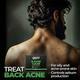 Beardo B-Acne Clear Bathing Bar 3's - Soaps