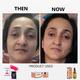 House of Beauty V Chin Uplifting Mask For Jawline, Double Chin Reduction with Collagen Gel 1's - Masks & Peels