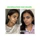 Plix The Plant Fix 2% Salicylic Acid Jamun Active Acne Control Dewy Serum 30 ml - Face Serum