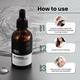 ThriveCo Anti - Dandruff Health Kit 300 ml - Hair Serums