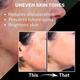 House of Beauty Brown Spot Corrector For Uneven Skin, Melasma, Acne with Salicylic, Niacin 15ml - Bb & Cc Creams