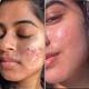 House of Beauty Anti Acne Foaming Facewash For Oily & Combination Skin with Salicylic 100ml - Face Wash & Cleansers