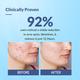 Fixderma Salyzap Acne Spot Corrector Gel with Salicylic Acid & Aczero Reduce Acne Pimples 20 gm - Face Moisturizers