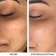 Professional O3+ Meladerm Vitamin C Gel Bleach 96 gm - Face Gels