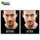 Garnier Men Acnofight Pimple Clearing Brightening Moisturiser 45 gm - Face Creams
