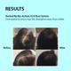 Dermistry Anti Hair Fall With Caffeine Collagen Arginine Shampoo 200 ml - Shampoos