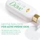 Dove 1% Salicylic Acid Formula Acne Clear Serum Body Wash, 300 ml - Shower Gels & Body Wash