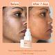 Wishcare Super Bright C16 Vitamin C Face Serum - Niacinamide, Kojic Acid and 4 - N - Br - For Pigmentation 30 ml - Face Serum