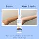 WishCare 10% AHA + 1% BHA Body Lotion - Smooths Rough & Bumpy Skin - With NiacinamiderapeFruit & Blueberry 200 ml - Lotions & Creams