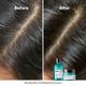 L'Oreal Professionnel Scalp Advanced Anti-Oiliness Dermo-Purifier Shampoo 300 ml - Shampoos